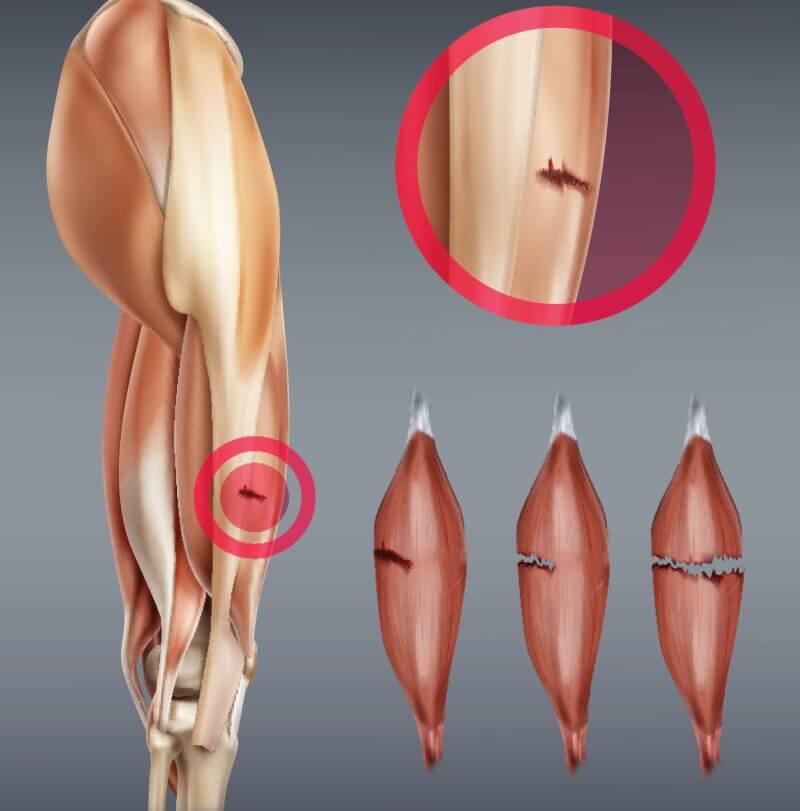 Objawy i kiedy do lekarza