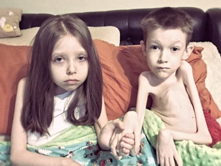 Przyczyny zaniku mięśni uda