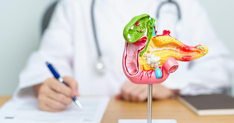 Dieta przy guzie brodawki Vatera