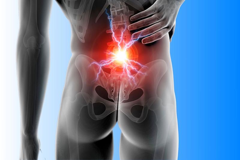 Objawy zespołu mięśnia gruszkowatego