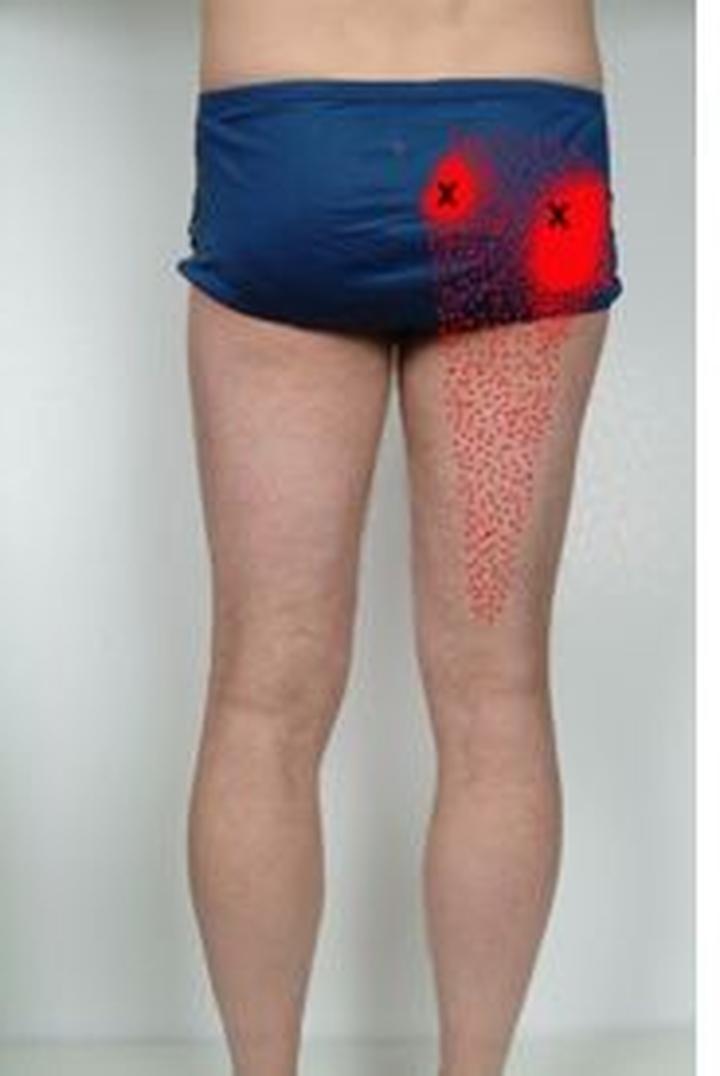 Różnicowanie z innymi schorzeniami ortopedycznymi