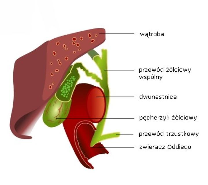 Jaką dietę stosować przy guzie brodawki Vatera? Praktyczne porady i wskazówki