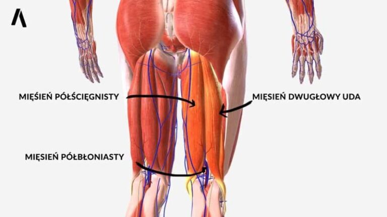 Objawy naciągnięcia mięśnia dwugłowego uda – jak je rozpoznać i co robić?