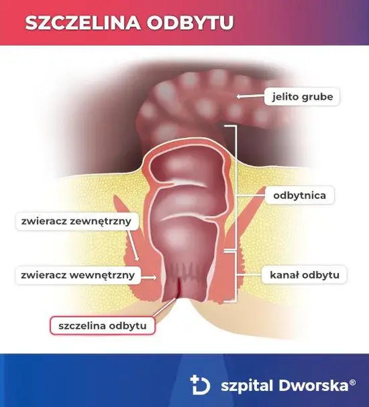 Ćwiczenia zwieraczy odbytu krok po kroku