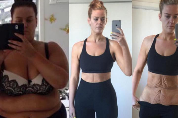 Psychologia odchudzania