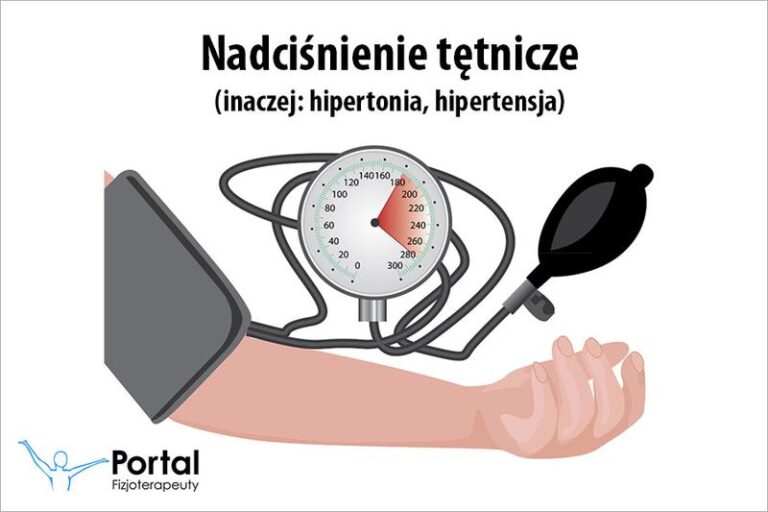 Czy z nadciśnieniem warto ćwiczyć na siłowni? Oto, co musisz wiedzieć!