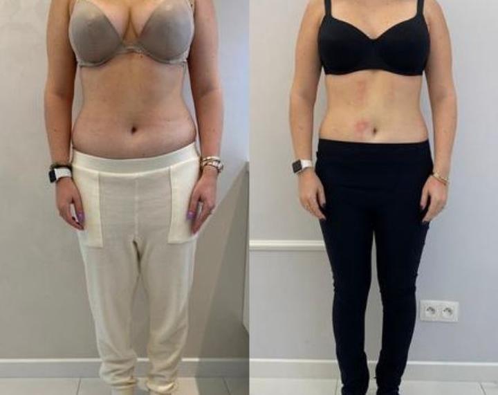 Skuteczne sposoby na zgubienie brzucha bez ćwiczeń – odkryj tajemnice szybkiej utraty wagi