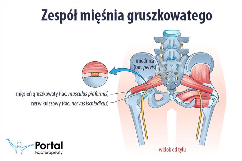 Techniki masażu i ćwiczenia na mięsień gruszkowaty