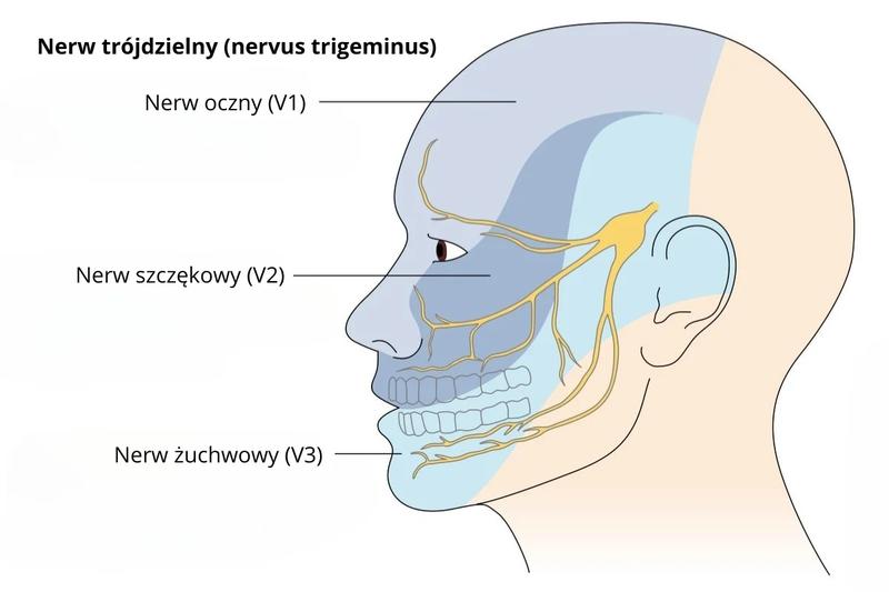 Objawy porażenia nerwu twarzowego
